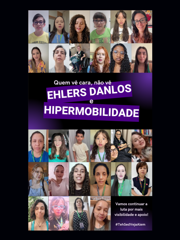 Campanha Zbra Rara 2025